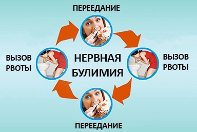 Лечение булимии в Тольятти